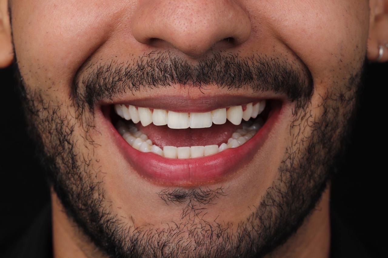 Odontología estética