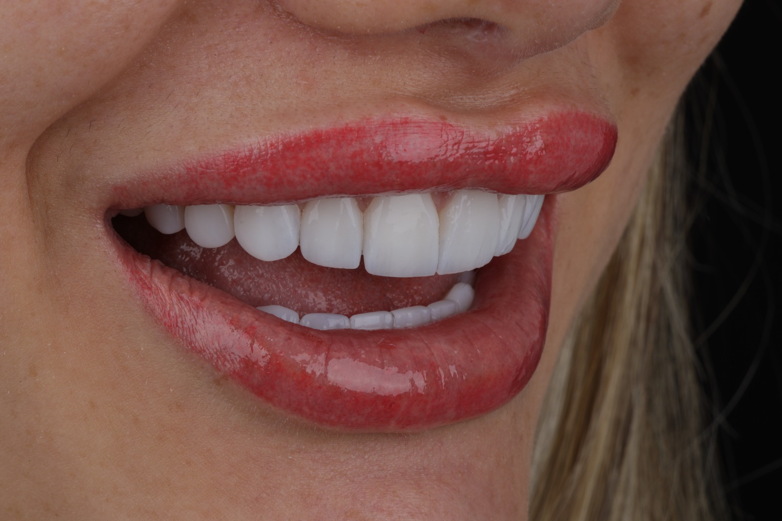 Sonrisa y salud bucal